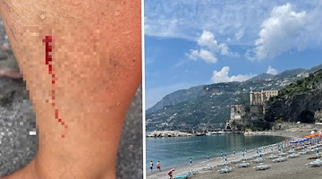 Maiori, pesce morde bagnante e centra una vena: necessario intervento dell'ambulanza 